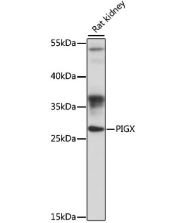 PIGX Rabbit Polyclonal Antibody