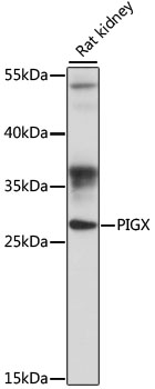 PIGX Rabbit Polyclonal Antibody