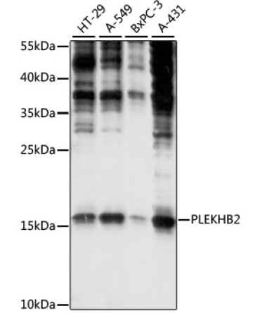 PLEKHB2 Rabbit Polyclonal Antibody