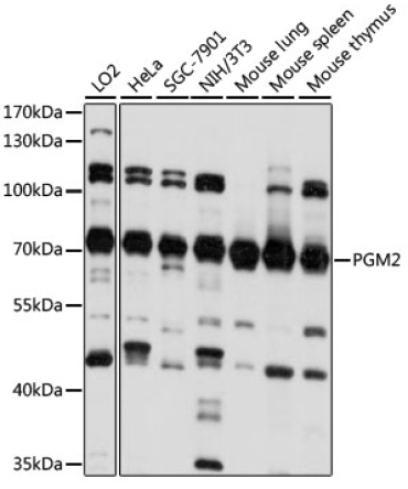 PGM2 Rabbit Polyclonal Antibody