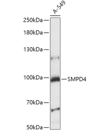 SMPD4 Rabbit Polyclonal Antibody