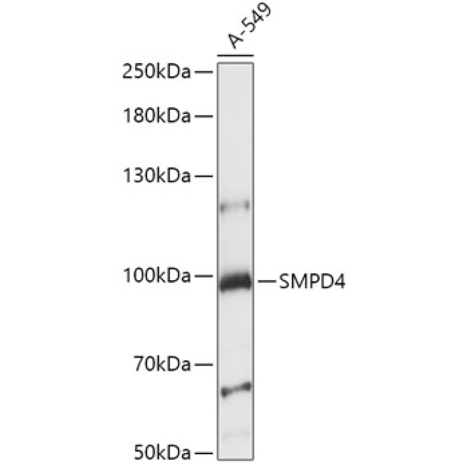 SMPD4 Rabbit Polyclonal Antibody