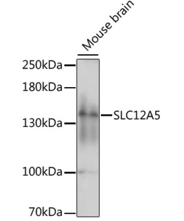 SLC12A5 Rabbit Polyclonal Antibody