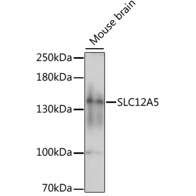 SLC12A5 Rabbit Polyclonal Antibody