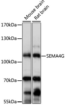 SEMA4G Rabbit Polyclonal Antibody