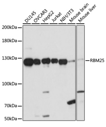 RBM25 Rabbit Polyclonal Antibody