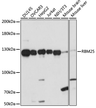 RBM25 Rabbit Polyclonal Antibody