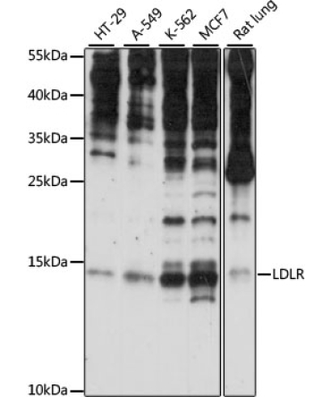 SNRNP25 Rabbit Polyclonal Antibody
