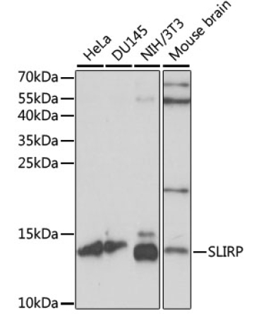 SLIRP Rabbit Polyclonal Antibody