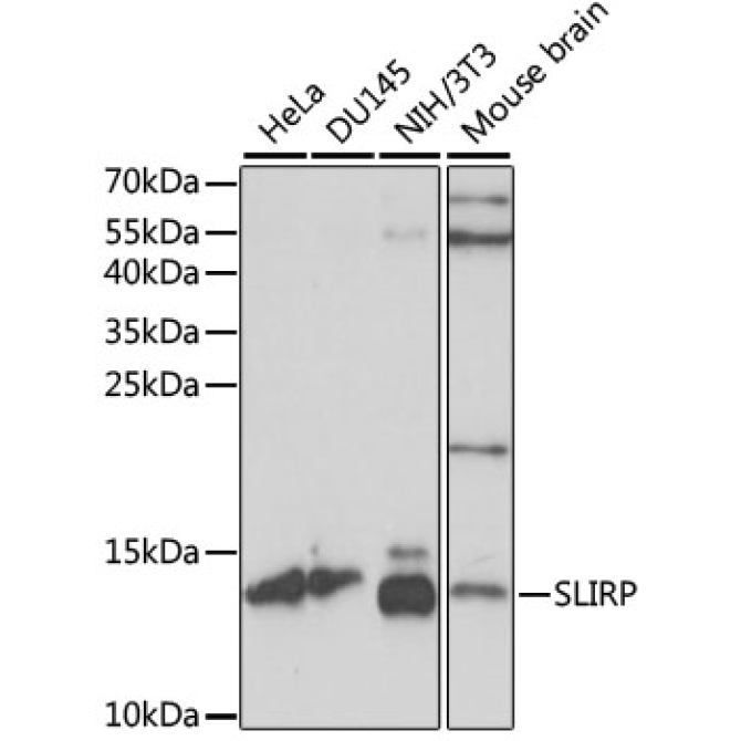 SLIRP Rabbit Polyclonal Antibody