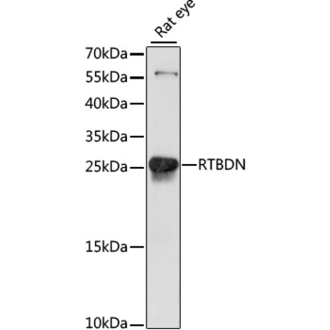 RTBDN Rabbit Polyclonal Antibody