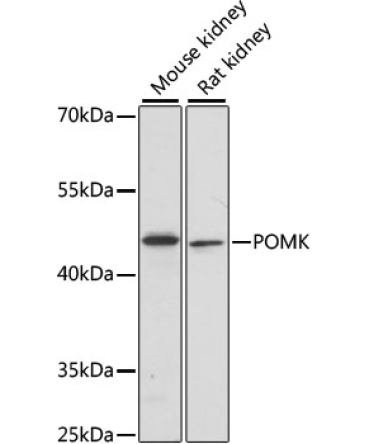 POMK Rabbit Polyclonal Antibody