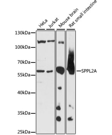 SPPL2A Rabbit Polyclonal Antibody
