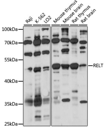 RELT Rabbit Polyclonal Antibody