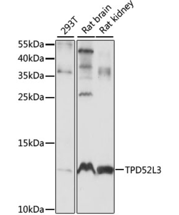 TPD52L3 Rabbit Polyclonal Antibody
