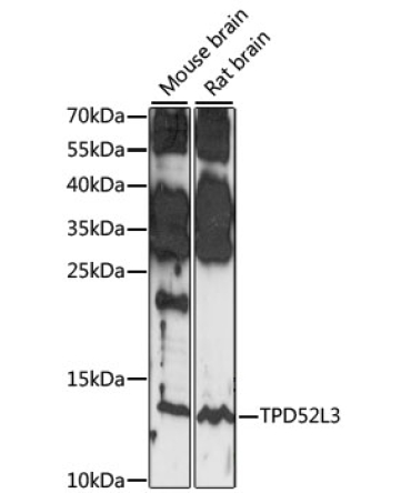 TPD52L3 Rabbit Polyclonal Antibody