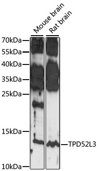 TPD52L3 Rabbit Polyclonal Antibody