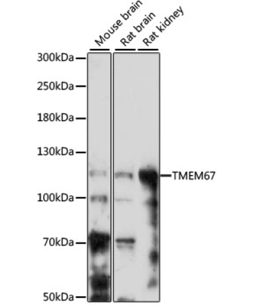 TMEM67 Rabbit Polyclonal Antibody