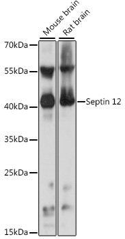 Septin 12 Rabbit Polyclonal Antibody
