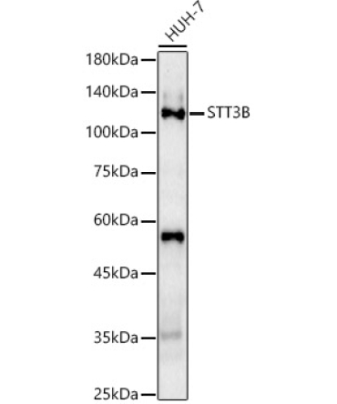 STT3B Rabbit Polyclonal Antibody