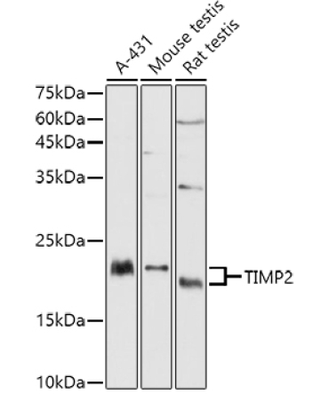 TIMP2 Rabbit Polyclonal Antibody