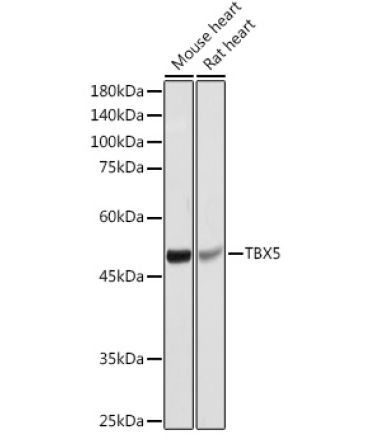 TBX5 Rabbit Polyclonal Antibody