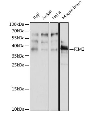PIM2 Rabbit Polyclonal Antibody
