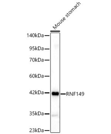 RNF149 Rabbit Polyclonal Antibody