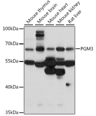 PGM3 Rabbit Polyclonal Antibody