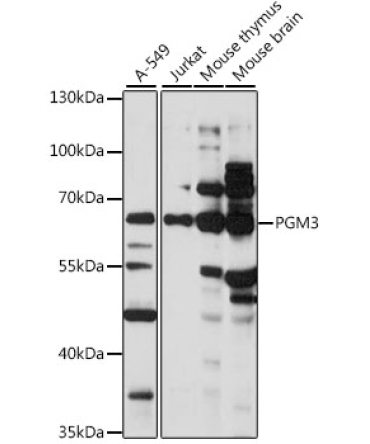 PGM3 Rabbit Polyclonal Antibody