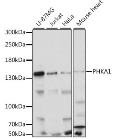 PHKA1 Rabbit Polyclonal Antibody