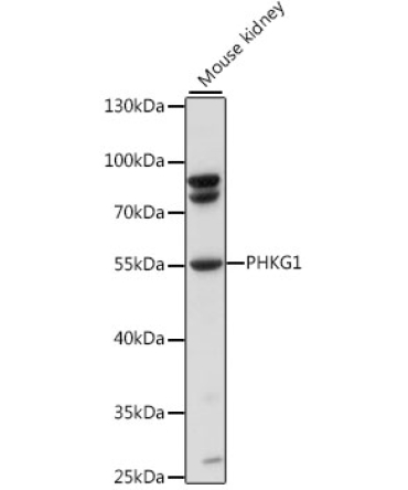 PHKG1 Rabbit Polyclonal Antibody