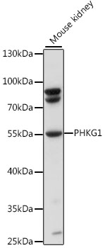 PHKG1 Rabbit Polyclonal Antibody