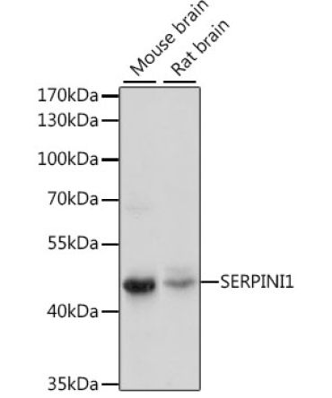 SERPINI1 Rabbit Polyclonal Antibody