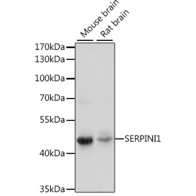 SERPINI1 Rabbit Polyclonal Antibody