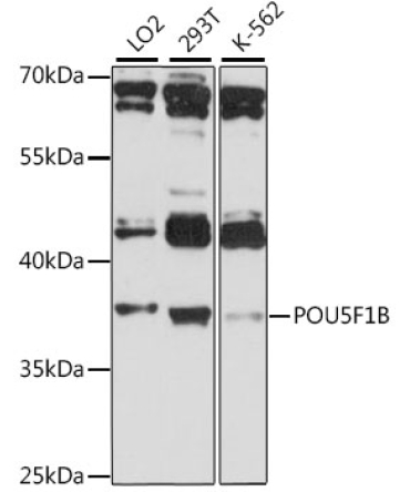 POU5F1B Rabbit Polyclonal Antibody