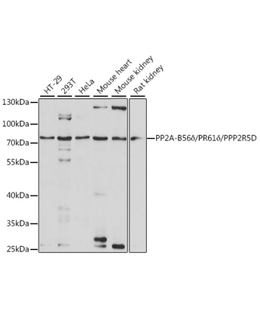 PP2A-B56Delta/PR61Delta/PPP2R5D Rabbit Polyclonal Antibody