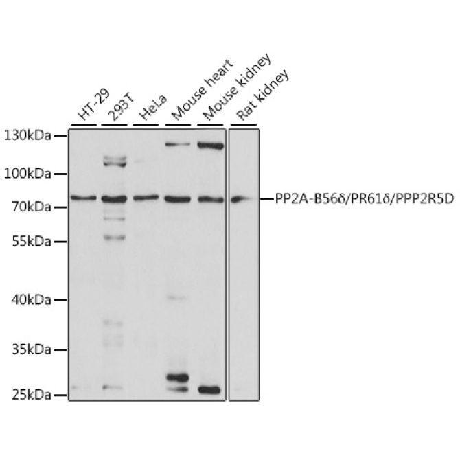 PP2A-B56Delta/PR61Delta/PPP2R5D Rabbit Polyclonal Antibody
