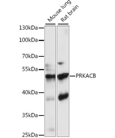 PKA C-beta (PRKACB) Rabbit Polyclonal Antibody