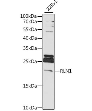 RLN1 Rabbit Polyclonal Antibody