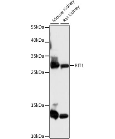 RIT1 Rabbit Polyclonal Antibody