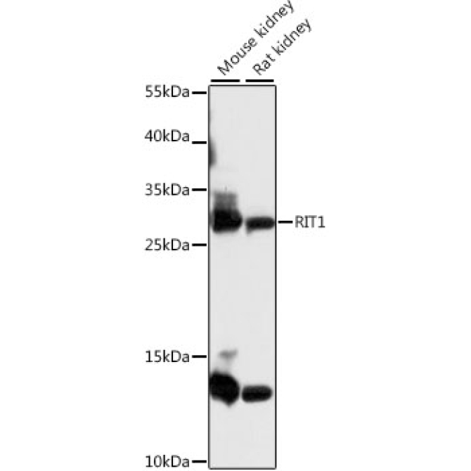 RIT1 Rabbit Polyclonal Antibody