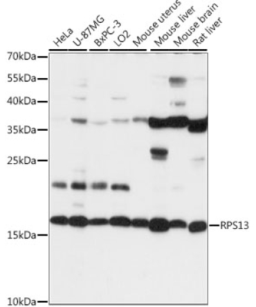RPS13 Rabbit Polyclonal Antibody
