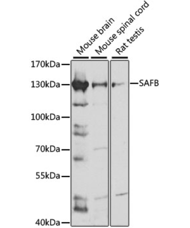 SAFB Rabbit Polyclonal Antibody