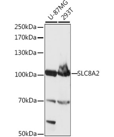 SLC8A2 Rabbit Polyclonal Antibody