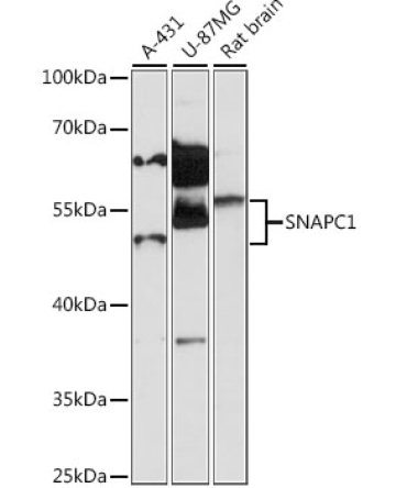 SNAPC1 Rabbit Polyclonal Antibody