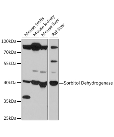 Sorbitol Dehydrogenase Rabbit Polyclonal Antibody