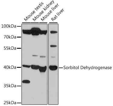 Sorbitol Dehydrogenase Rabbit Polyclonal Antibody