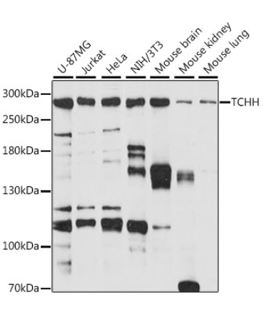 TCHH Rabbit Polyclonal Antibody