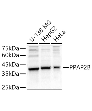PPAP2B Rabbit Polyclonal Antibody